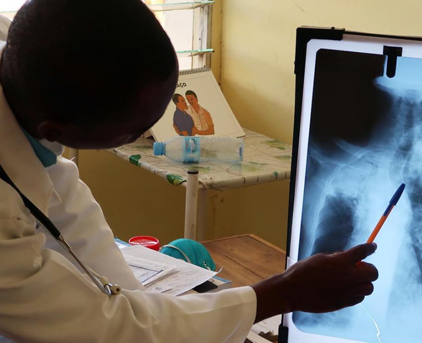 Tuberculosis, una enfermedad que nunca ha desaparecido 