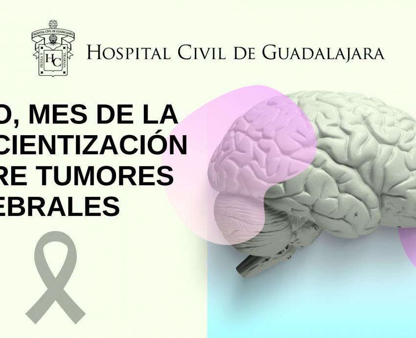 Detección a tiempo, paso clave en tratamiento de tumores cerebrales