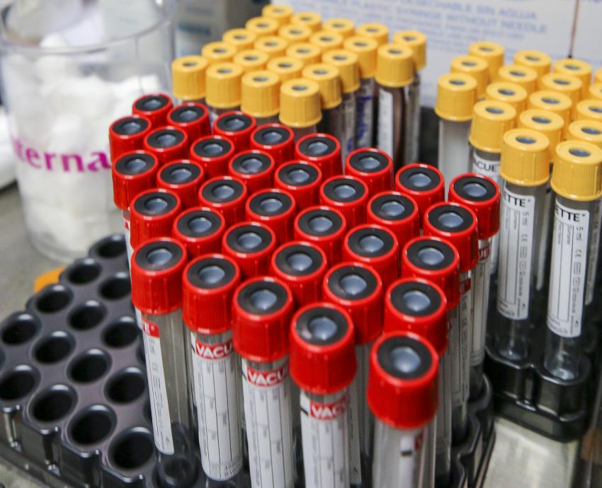 Dengue en México se intensifica cada 5 años, revela investigación del CUTlajomulco