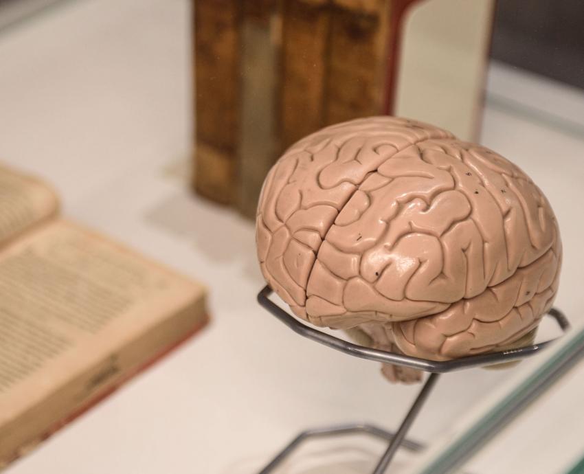 Uno de cada tres pacientes presenta resistencia a tratamientos contra epilepsia 