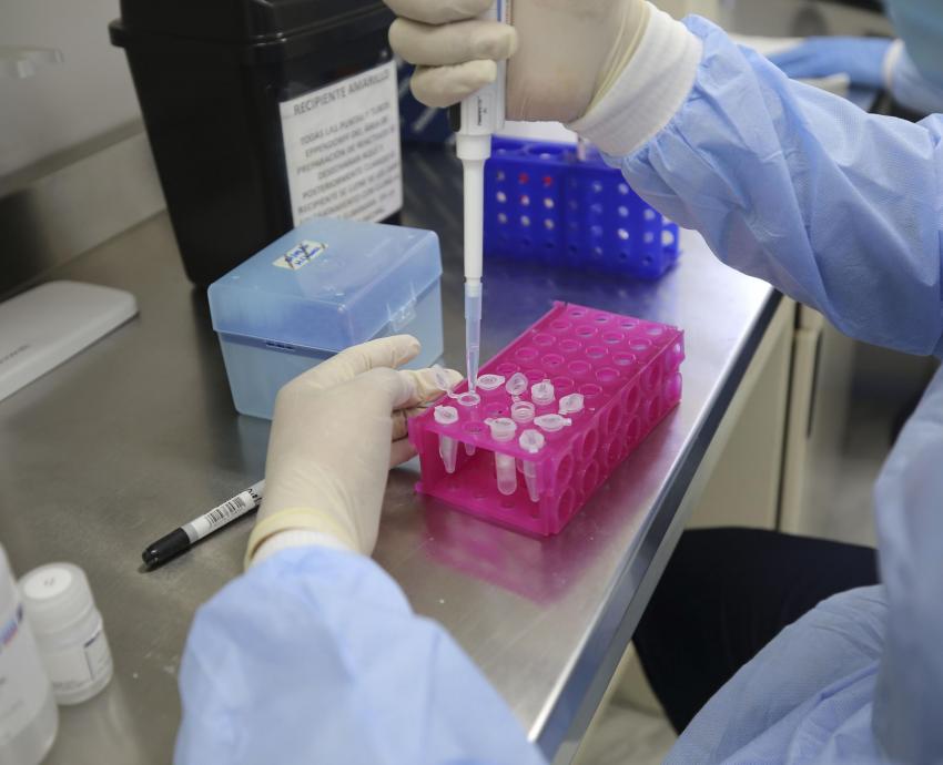 Riesgo de propagación masiva de hantavirus es bajo, aseguran especialistas del HCG